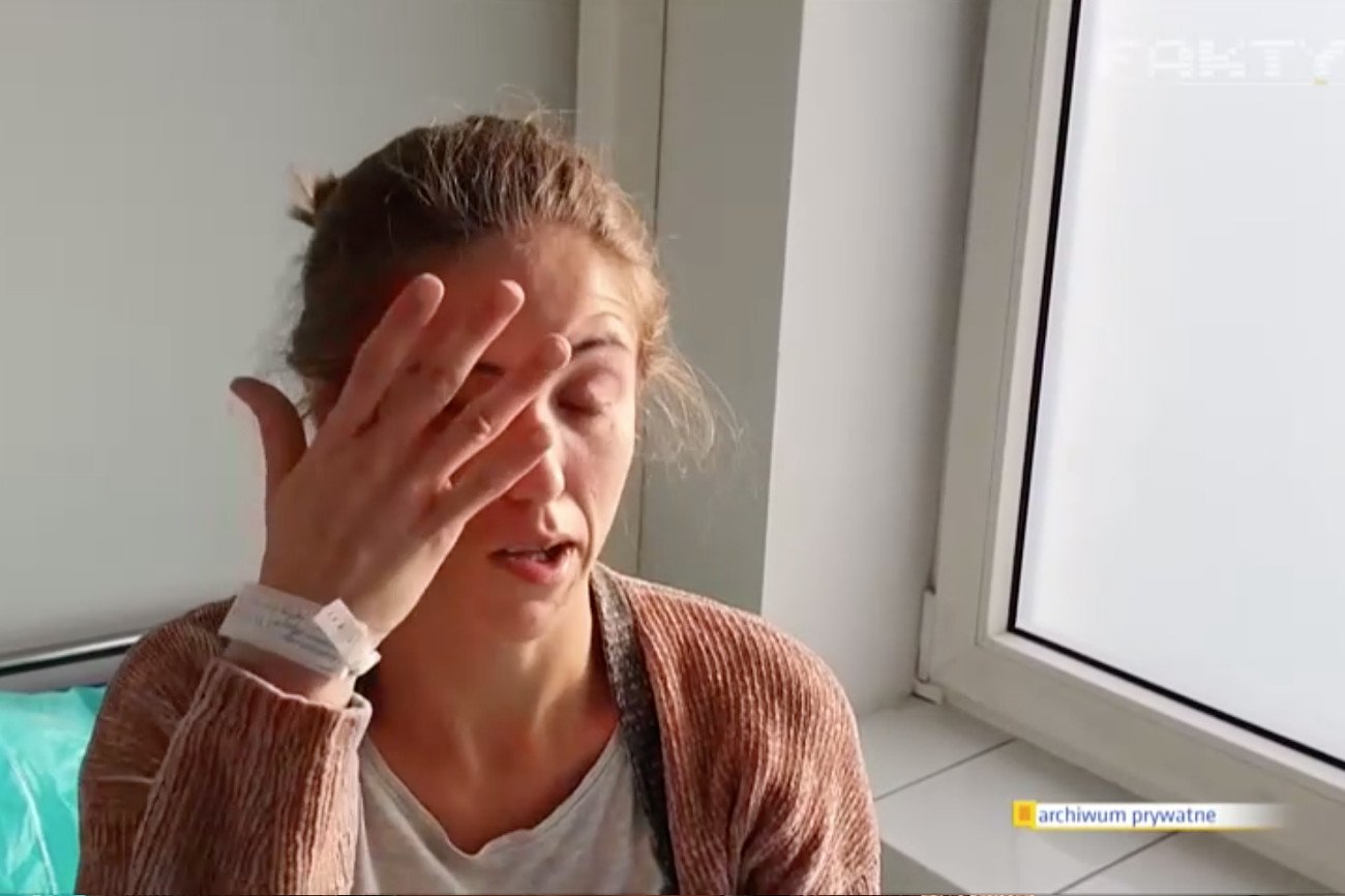 Patrycja Kwiatkowska z Legnicy. Pacjentka chora na COVID-19. Koronawirus sparaliżował jej twarz