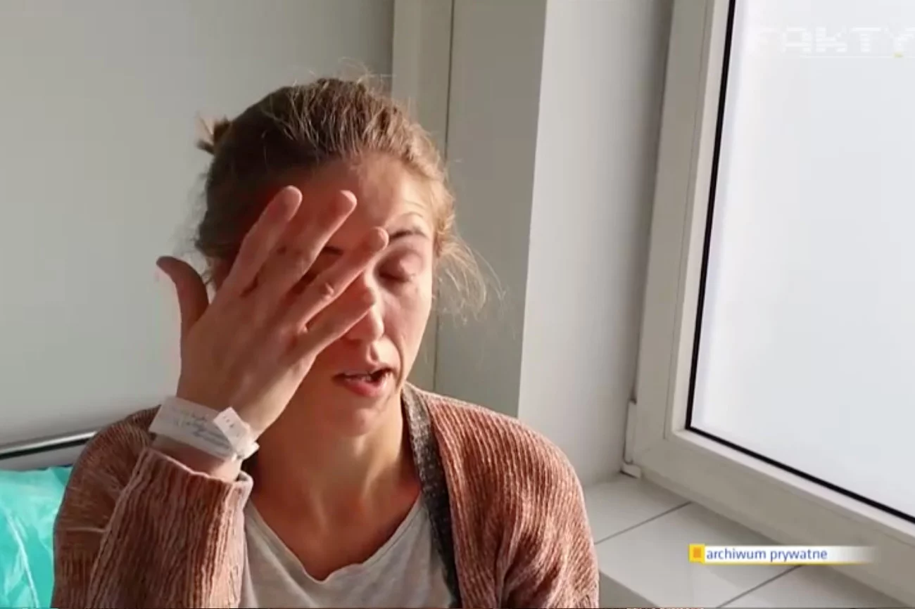 Patrycja Kwiatkowska z Legnicy. Pacjentka chora na COVID-19. Koronawirus sparaliżował jej twarz