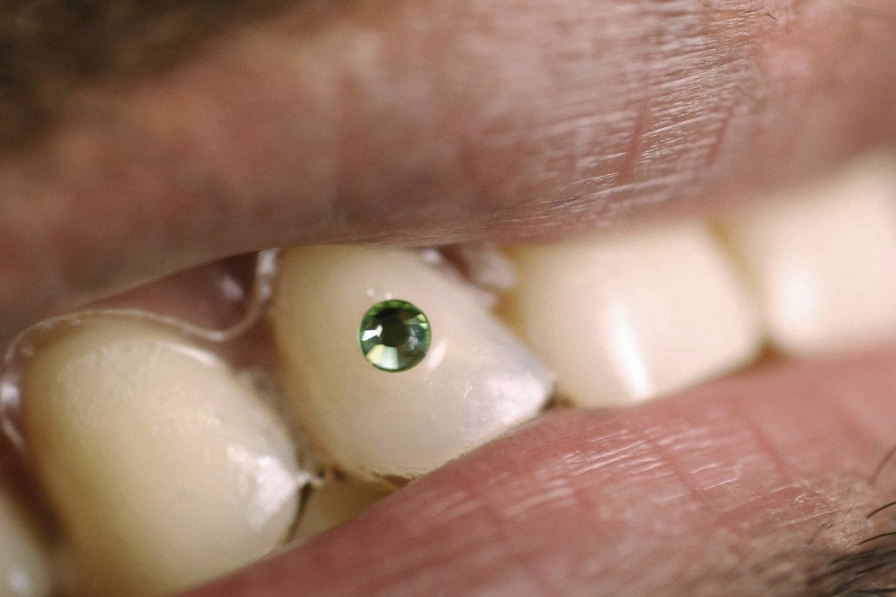 Hit czy kit? Biżuteria na zębach co jakiś czas wraca do łask.