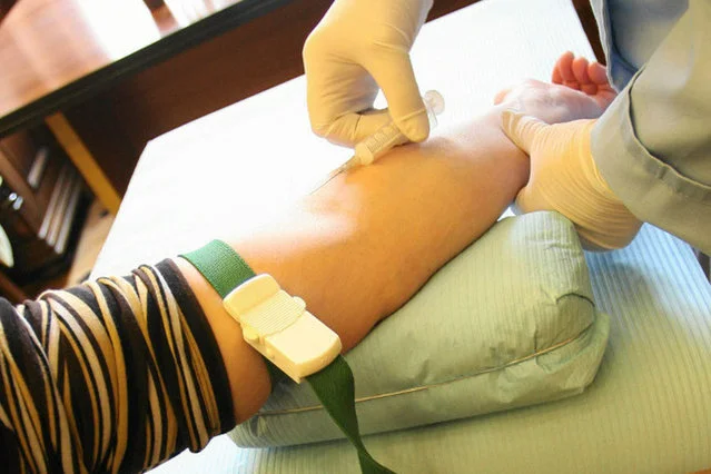 Robiłeś badania, byłeś u dentysty, kosmetyczki, pobierali ci krew? Zrób test anty-HCV.