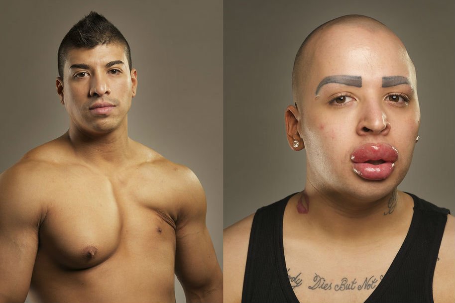 Operacje plastycznie czasami prowadzą do oszpecenia i kalectwa