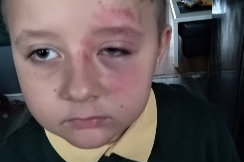 W szkole w Halfax pobito 7-letniego Polaka.