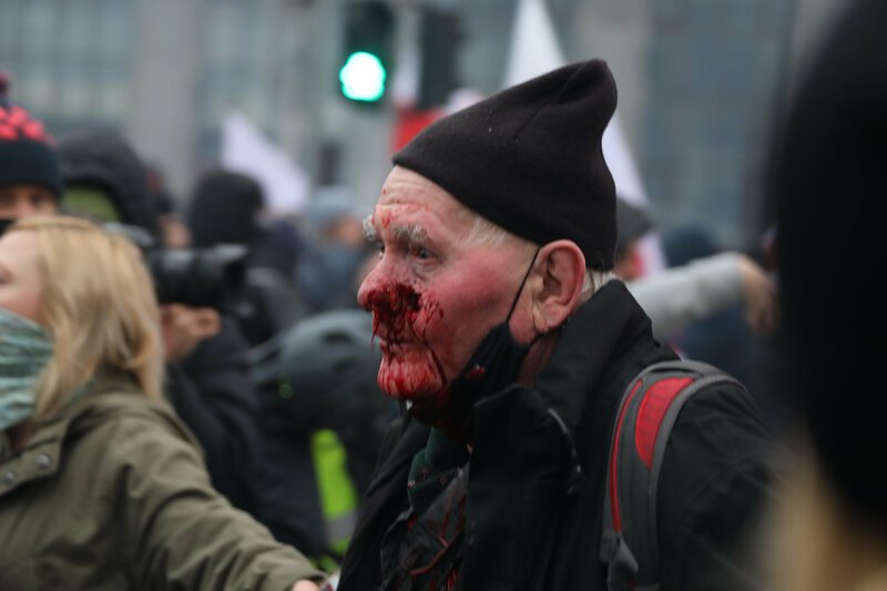 Fotoreporter postrzelony przez policję na Marszu Niepodległości żąda wielkiego odszkodowania.