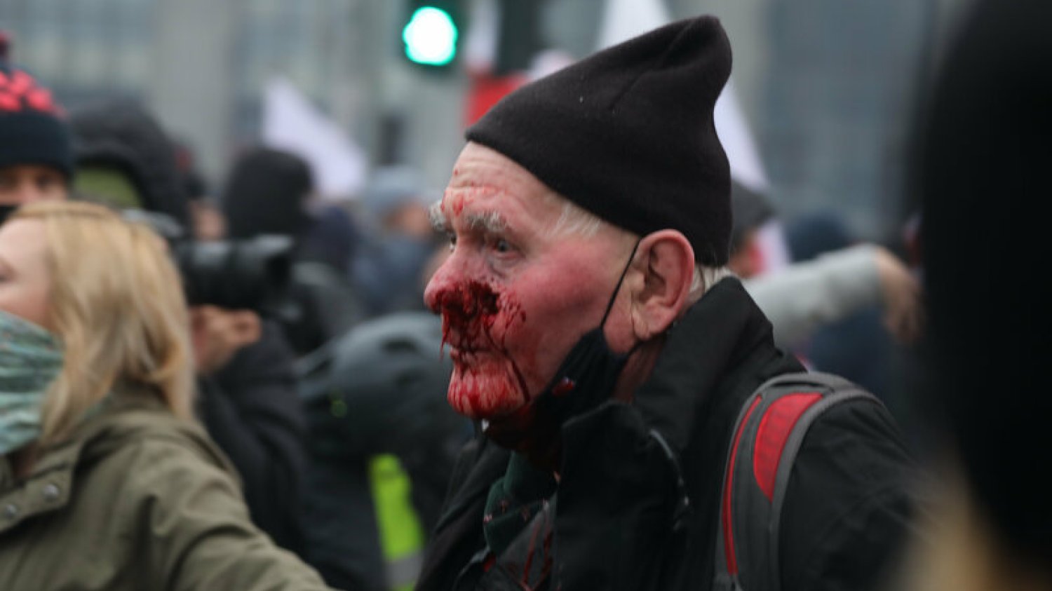 Fotoreporter postrzelony przez policję na Marszu Niepodległości żąda wielkiego odszkodowania.