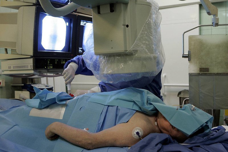 Zabieg koronarografii.