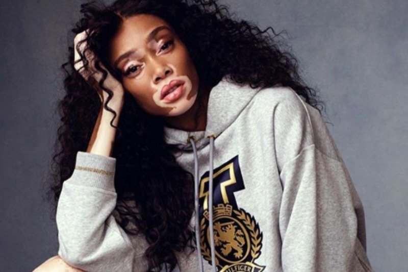 Winine Harlow uczyniła ze swojej inności atut