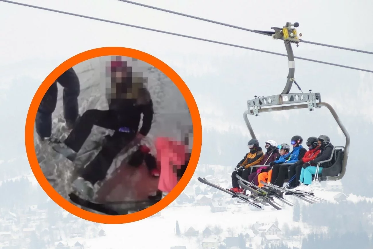 Nastolatka stratowana na stoku w Istebnej Wypadek na stoku w Istebnej