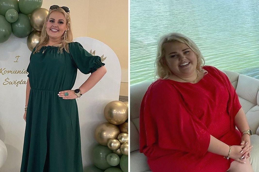 Kinga Zawodnik operacja, Kinga Zawodnik schudła, Kinga Zawodnik waga, Kinga Zawodnik przed i po