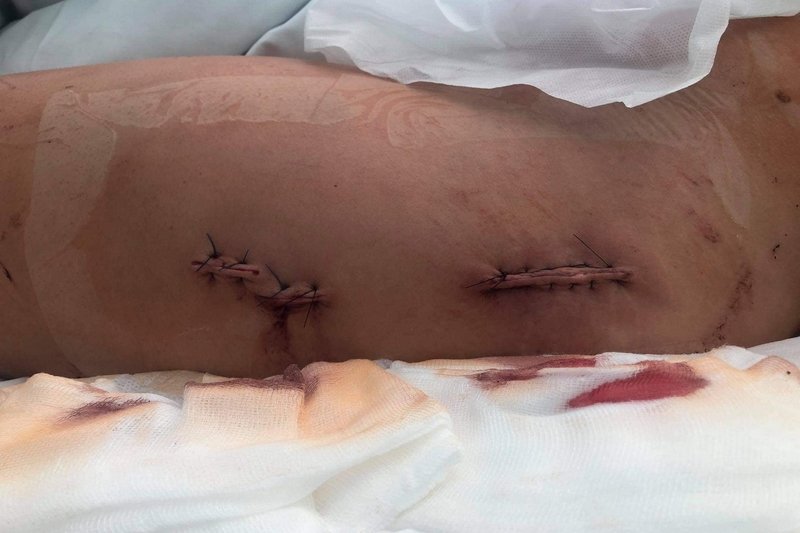 Daria Chojnacka miała wypadek.