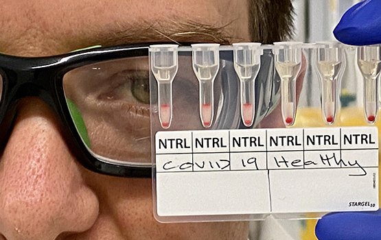 Szybki test krwi na koronawirusa daje wynik już po 20 minutach.