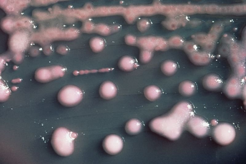 Kolonia bakterii Klebsiella pneumoniae. To właśnie jeden z jej szczepów okazał się być odporny na wszystkie znane rodzaje antybiotyków.