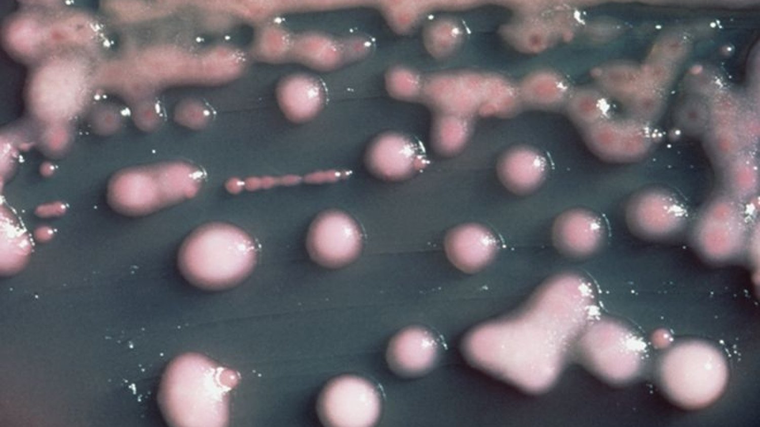 Kolonia bakterii Klebsiella pneumoniae. To właśnie jeden z jej szczepów okazał się być odporny na wszystkie znane rodzaje antybiotyków.