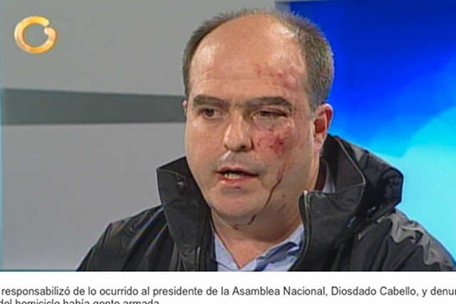 Julio Borges jeden z wenezuelskich polityków po bójce w parlamencie.