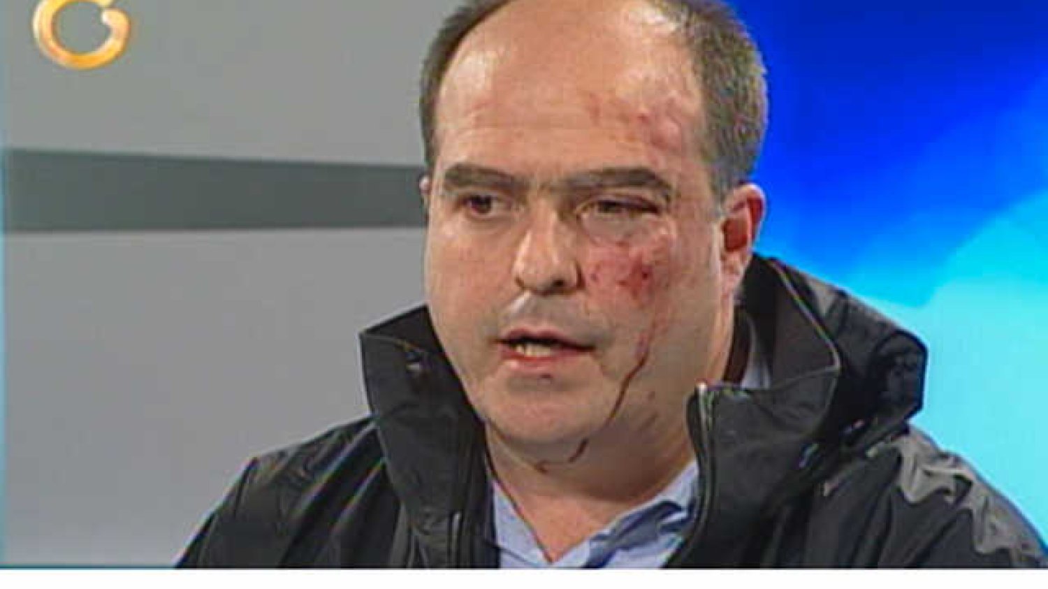 Julio Borges jeden z wenezuelskich polityków po bójce w parlamencie.