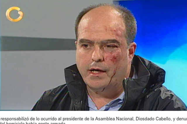 Julio Borges jeden z wenezuelskich polityków po bójce w parlamencie.