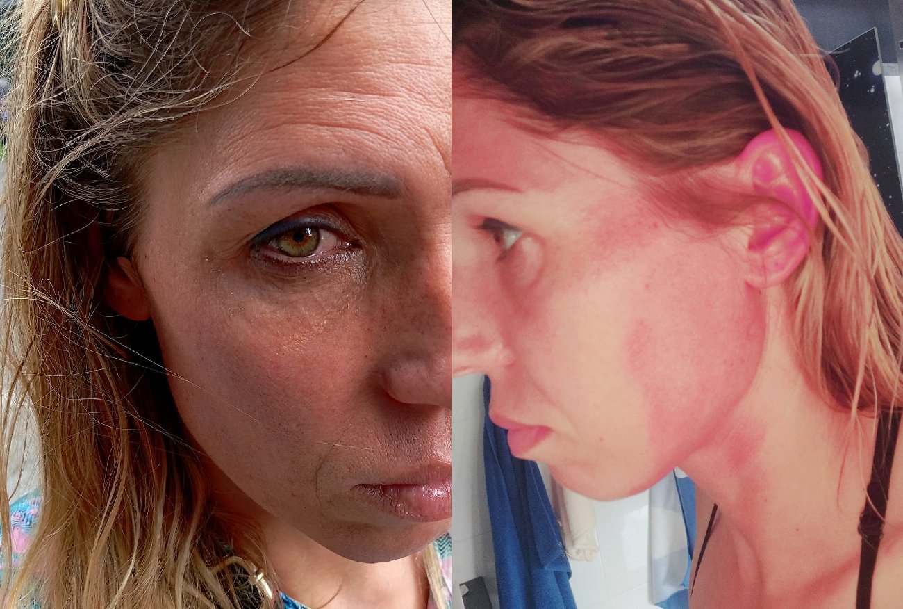 Zofia Klepacka pobita w Warszawie. Do sieci trafiły zdjęcia.