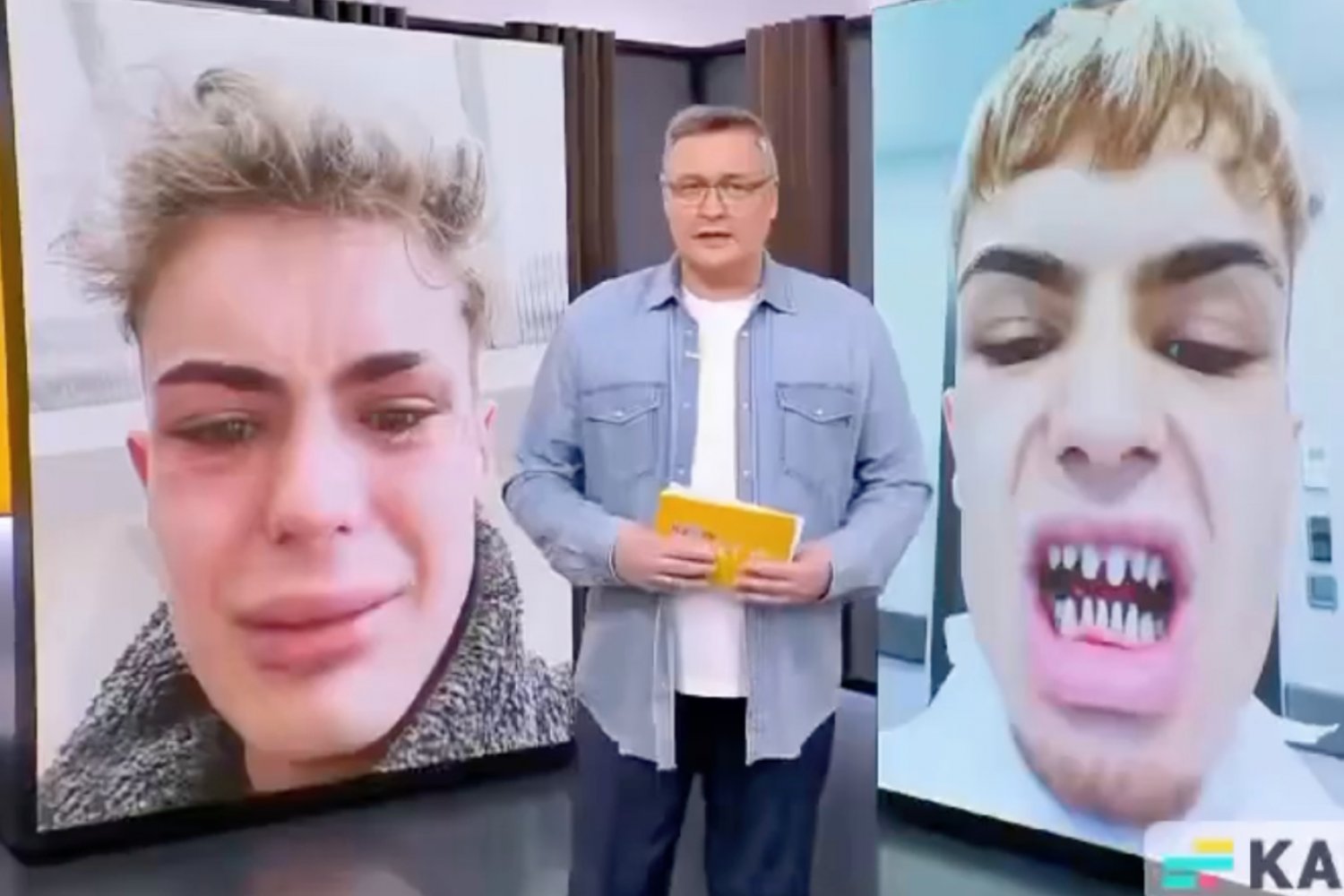 Aspirujący model zrobił zęby w Turcji. Teraz "wygląda jak rekin" [FOTO]