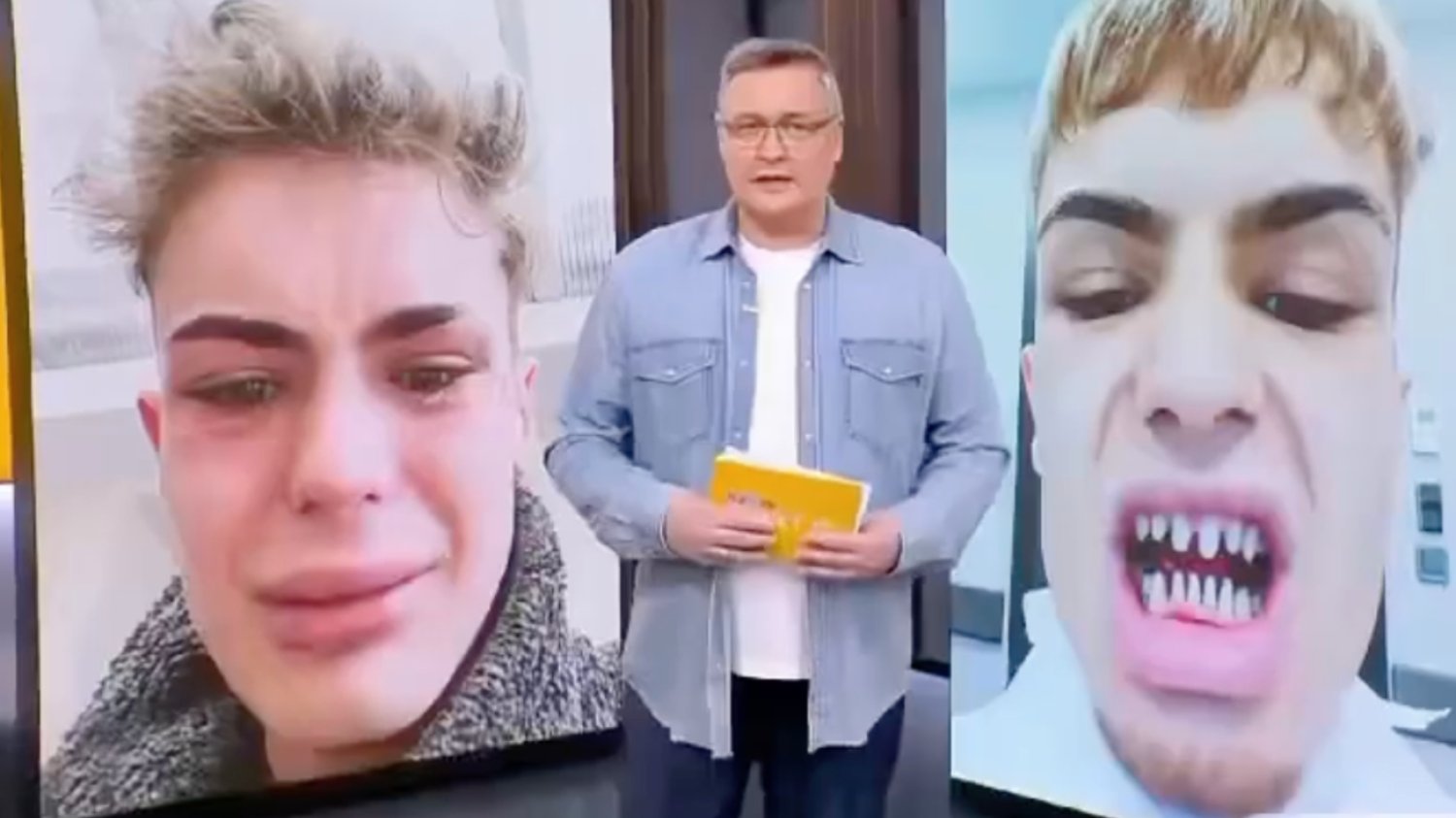 Aspirujący model zrobił zęby w Turcji. Teraz "wygląda jak rekin" [FOTO]