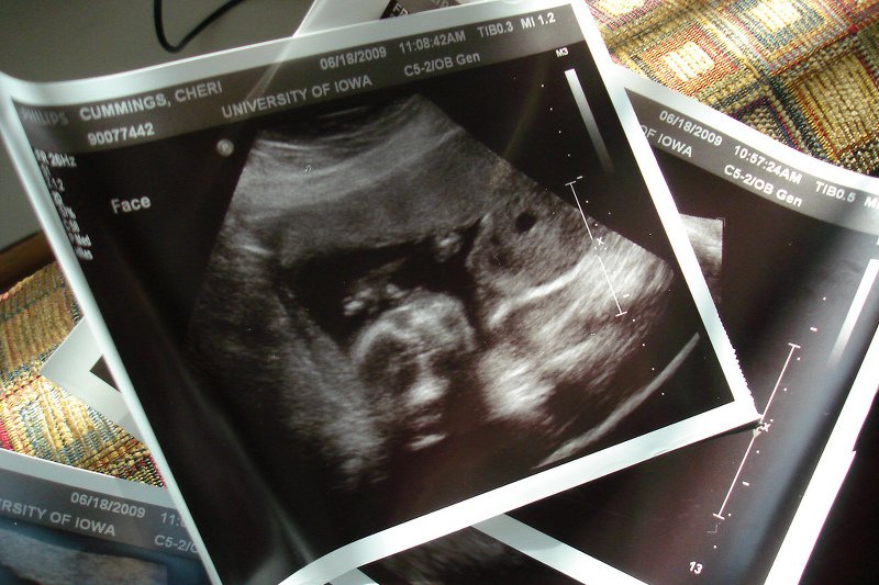 Urodzenie dziecka po 60-tce jest możliwe, ale czy słuszne?