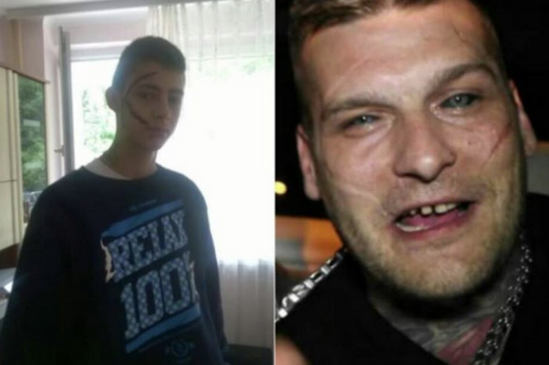 Karol z Kalisza okaleczył twarz, żeby upodobnić się do swojego idola.