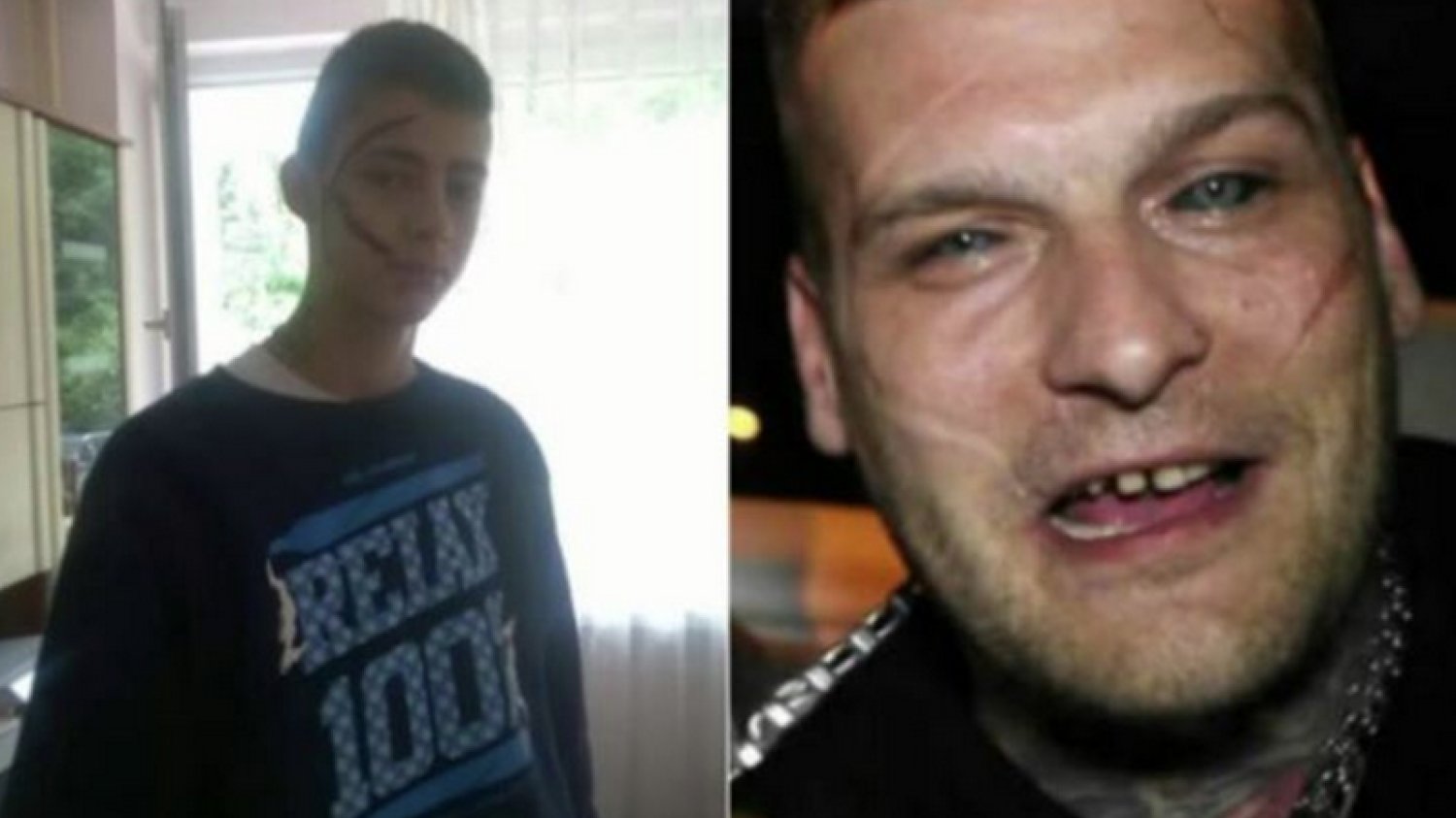 Karol z Kalisza okaleczył twarz, żeby upodobnić się do swojego idola.