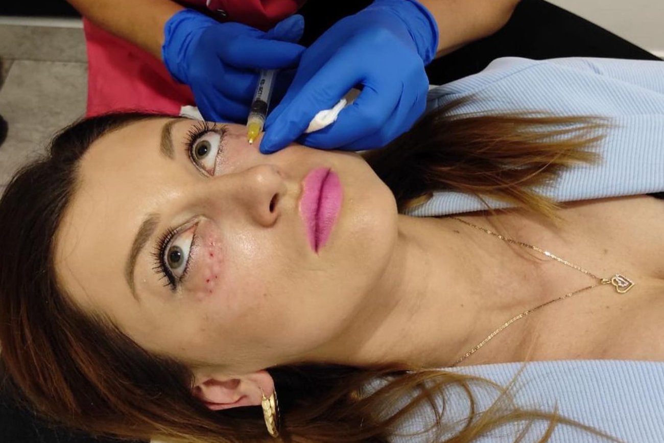 Justyna Żyła poprawia urodę. Zdjęcie z ostatniego zabiegu przyprawia o dreszcze