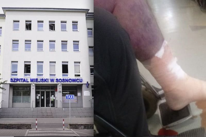 Z nogi mężczyzny na izbie przyjęć sączyły się płyny. Pacjent zmarł w szpitalu.