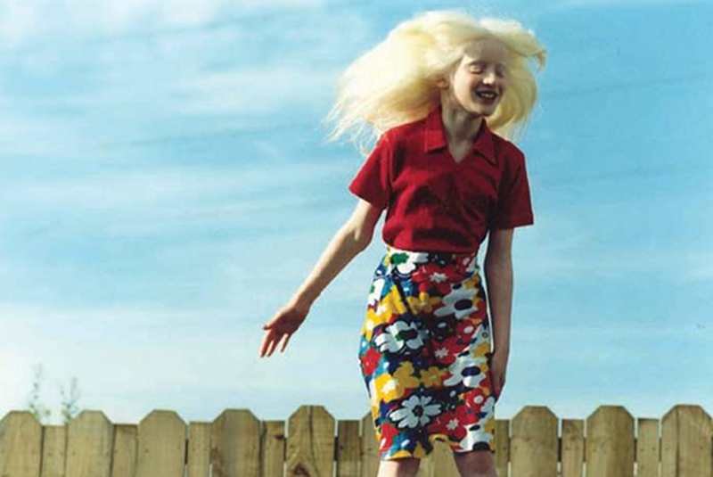 Kakay, albinoska z Indii