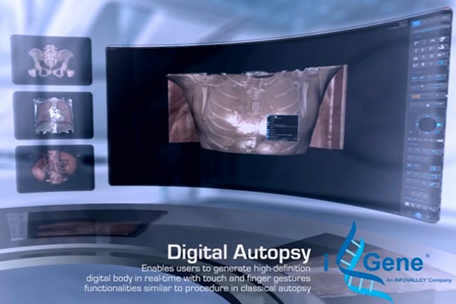 Cyfrowa autopsja trafi także do Polski?