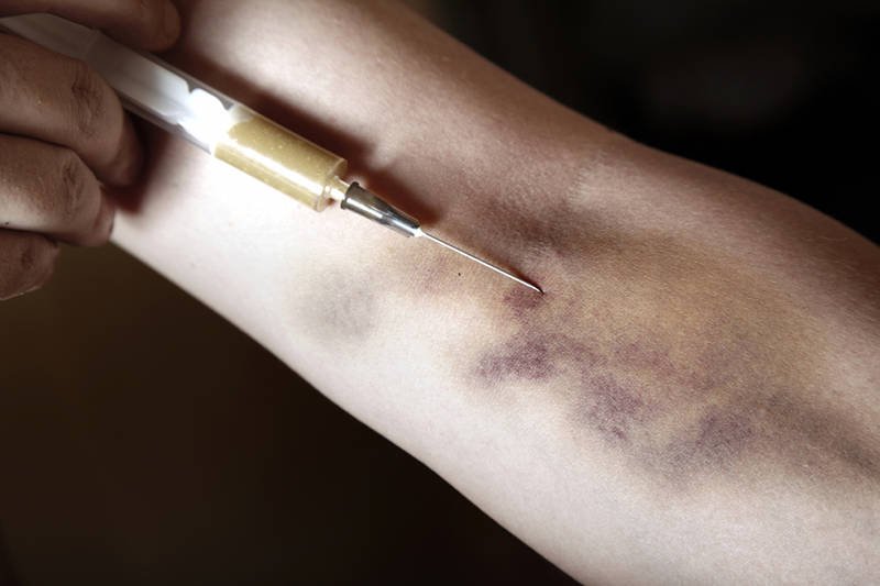 Czy "krokodyl", uznawany za jeden z najniebezpieczniejszych [url=http://shutr.bz/172ZnNa]narkotyków[/url] świata, może być zagrożeniem także w Polsce?