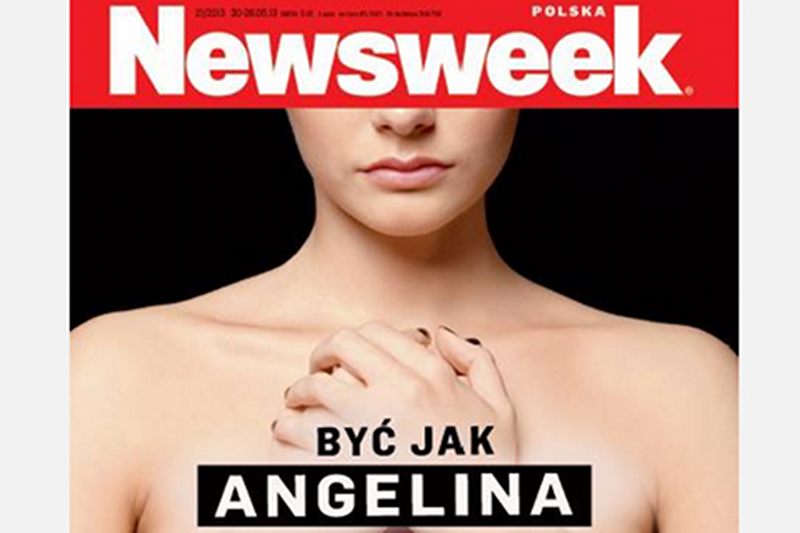 "Newsweek" rozmawia z kobietą, która podobnie jak Angelina Jolie poddała się zabiegowi podwójnej mastektomii