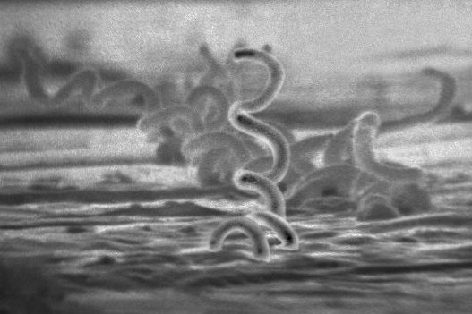 Krętki blade, bakterie wywołujące kiłę