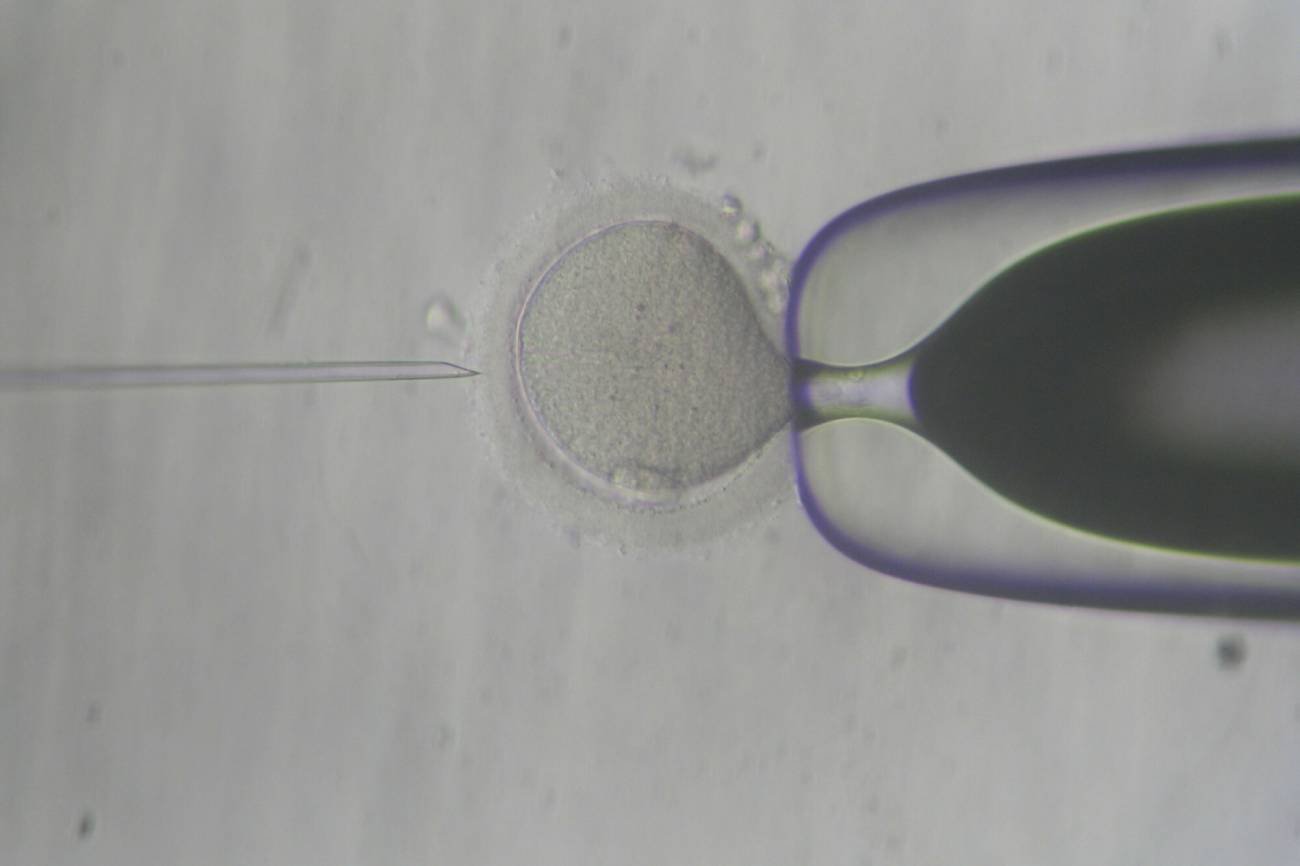 Kanadyjski ginekolog Norman Barwin zajmuje się na co dzień leczeniem niepłodności. W ostatnich dniach mężczyzna otrzymał jednak pozew zbiorowy, ponieważ okazało się, że lekarz niewłaściwie używał swojego nasienia (zdjęcie ilustracyjne)