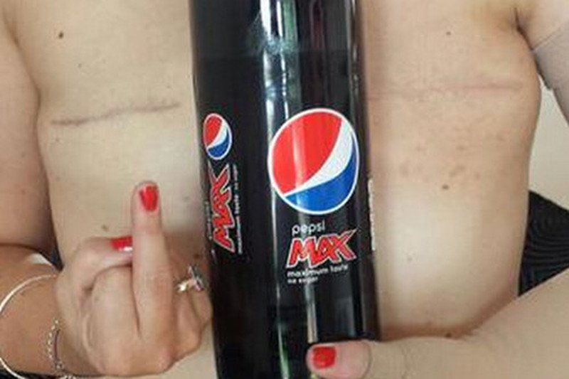 Zdjęcie kobiety po podwójnej mastektomii zostało usunięte przez administratorów Facebooka.