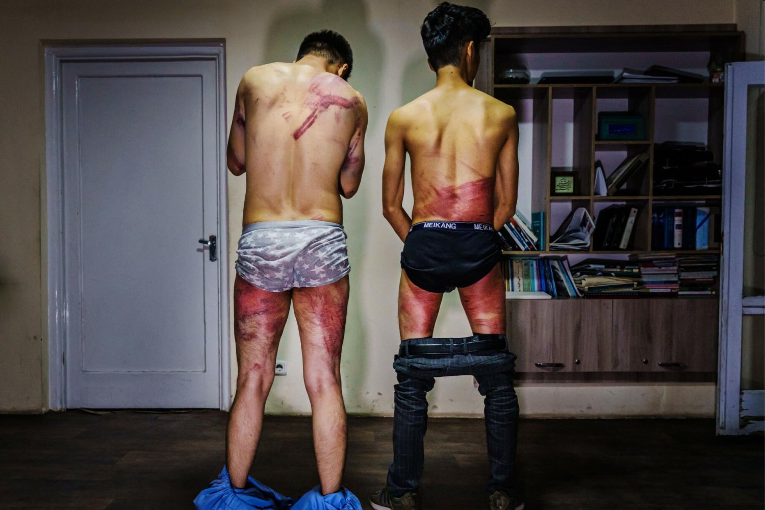 Koszmarne zdjęcia pobitych przez talibów dziennikarzy obiegły świat.