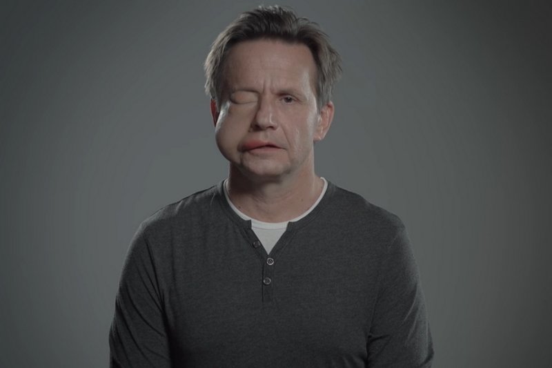 Bartłomiej Topa wziął udział w akcji charytatywnej dot. choroby HAE.