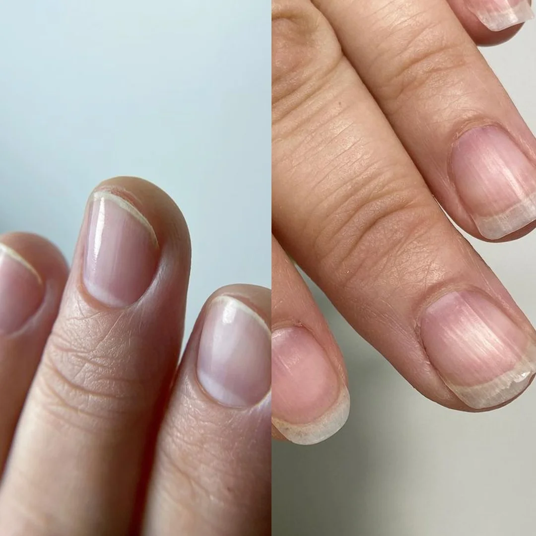 Manicure japoński: efekt przed i po