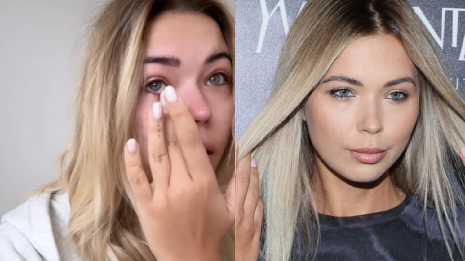 Sandra Kubicka o swoim stanie zdrowia.