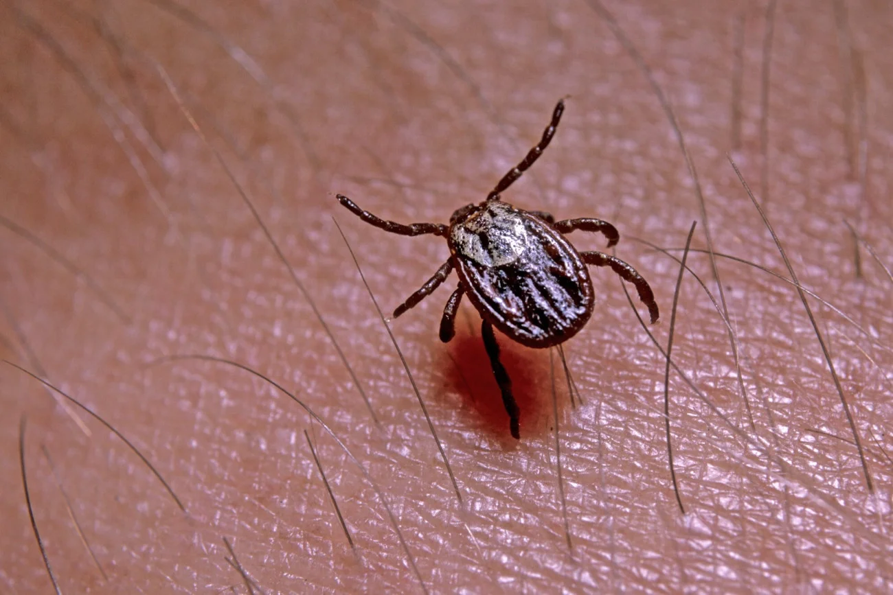 Po każdym powrocie ze spaceru na łąkę czy do lasu dokładnie obejrzyj całe ciało w poszukiwaniu kleszczy.