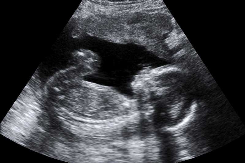 Urugwaj legalizuje aborcję. Zabieg można będzie przeprowadzić do 12. tygodnia ciąży.