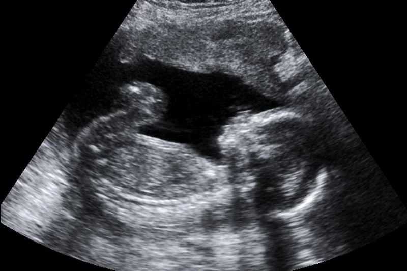 Urugwaj legalizuje aborcję. Zabieg można będzie przeprowadzić do 12. tygodnia ciąży.