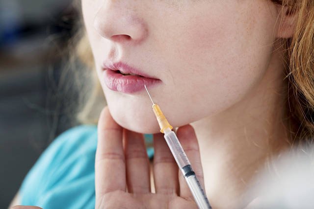 Zabiegi związane z iniekcją, jak wypełnianie ust kwasem hialuronowym można wykonywać przez cały rok