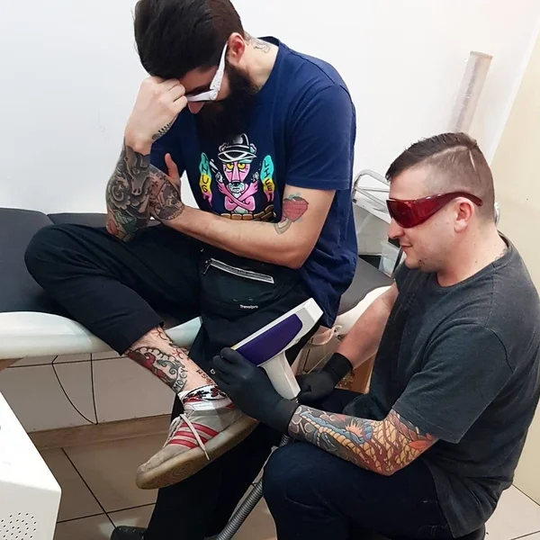 Robienie tatuażu boli, jednych mniej, drugich bardziej. Usuwanie laserowe też nie należy do super przyjemnych zabiegów niestety...