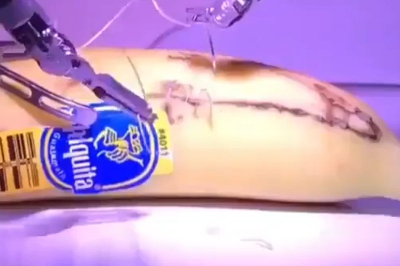 Lekarz w Londynie, Banan w Kalifornii. Telechirurgia możliwa dzięki technologii 5G.