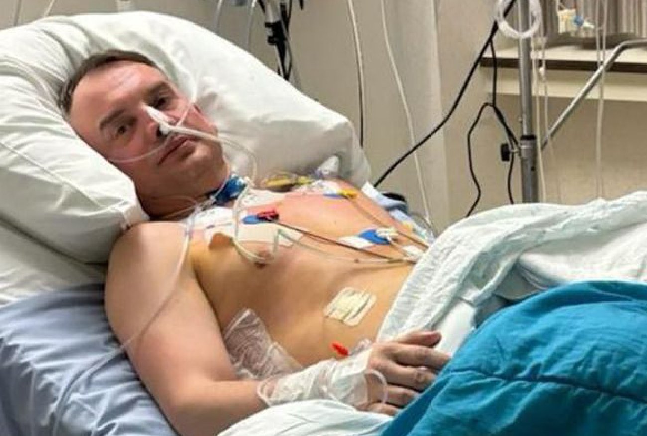 Czy po każdej chemii wypadają włosy? Zbigniew Ziobro znów wywołał emocje.