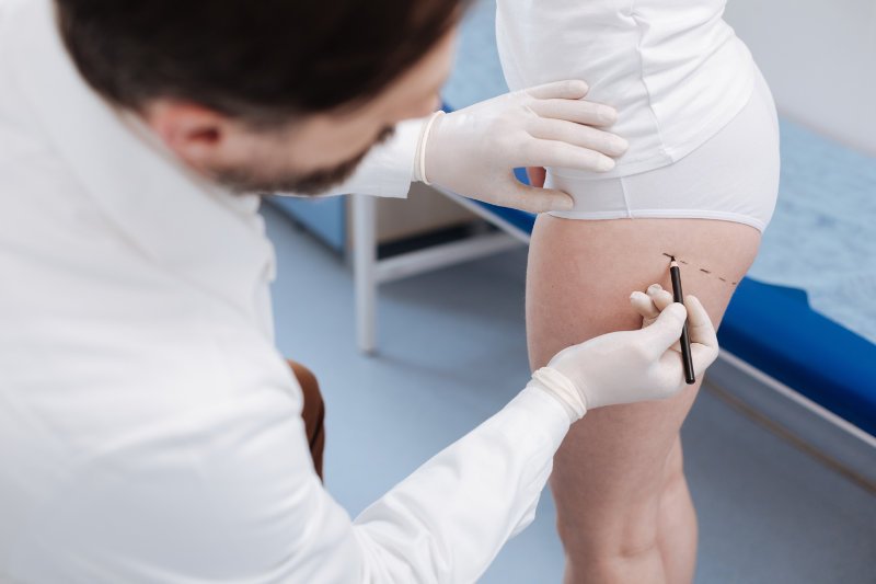 Liposukcja to bardzo popularny zabieg. Jak powinien przebiegać, aby efekty były zadowalające?