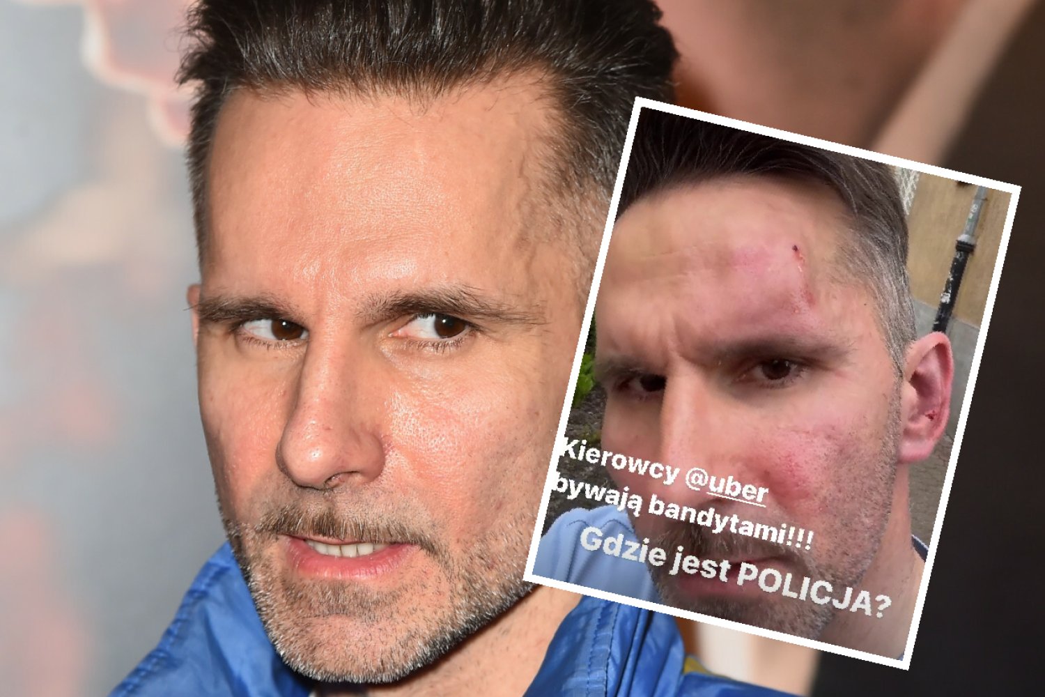 Marcin Bosak został dotkliwie pobity na ulicy. "Gdzie jest policja?"