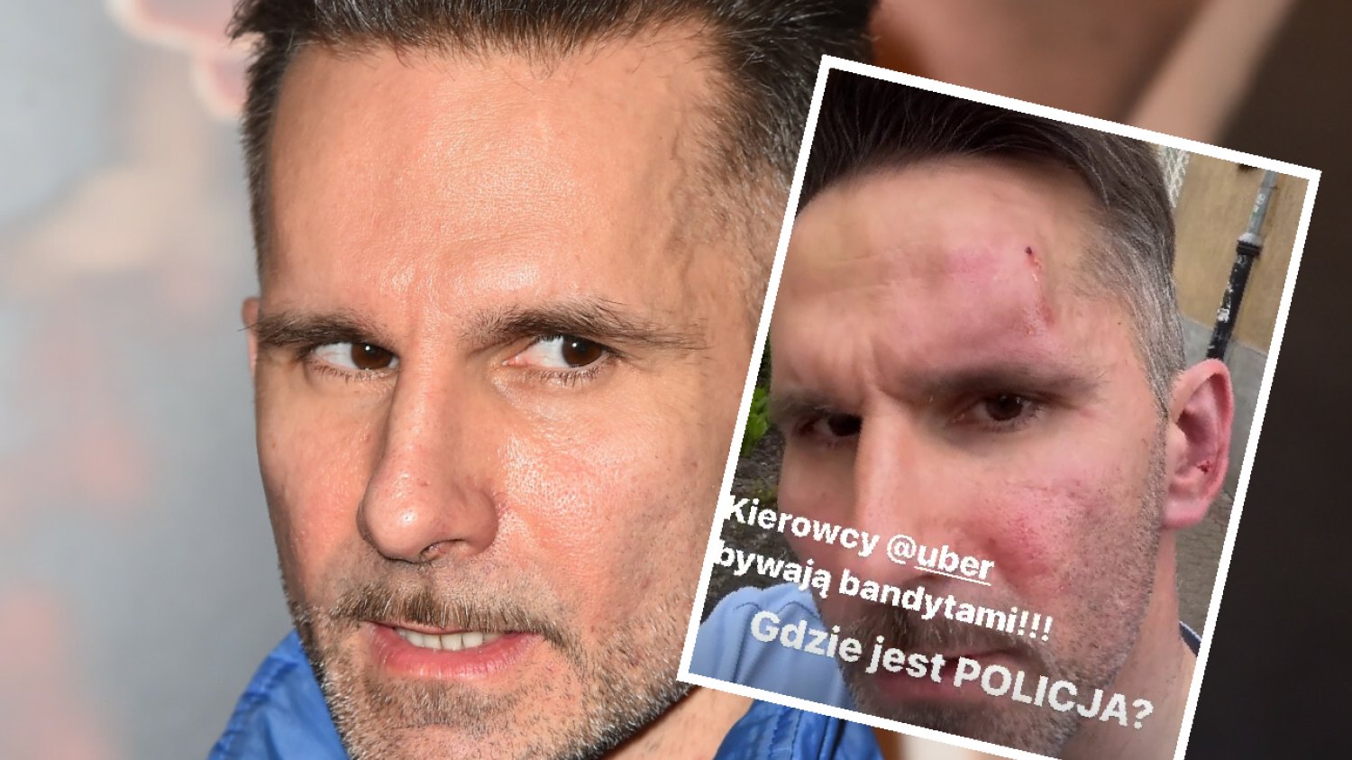 Marcin Bosak został dotkliwie pobity na ulicy. "Gdzie jest policja?"