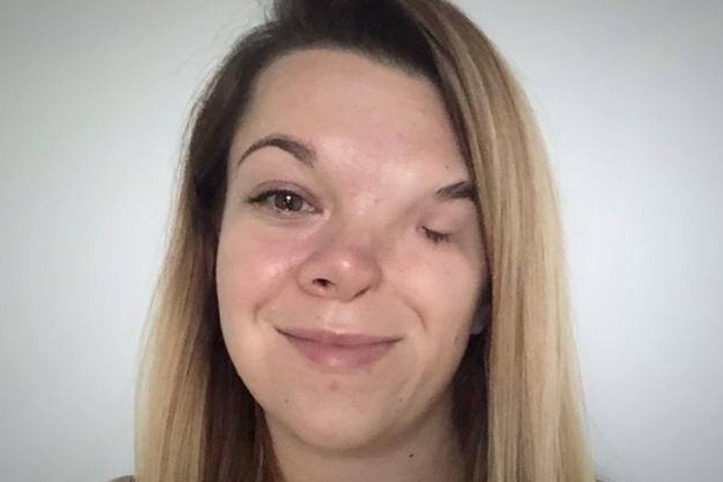 Anna Krawczunas-Kowalczyk potrzebuje operacji rekonstrukcji połowy twarzy.