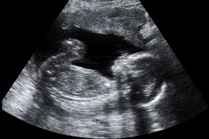 Niemcy bardziej niż aborcję potępiają jazdę pod wpływem alkoholu.